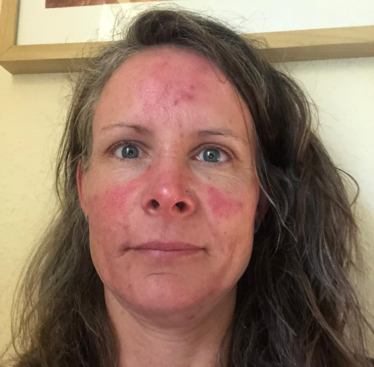 image comparison before