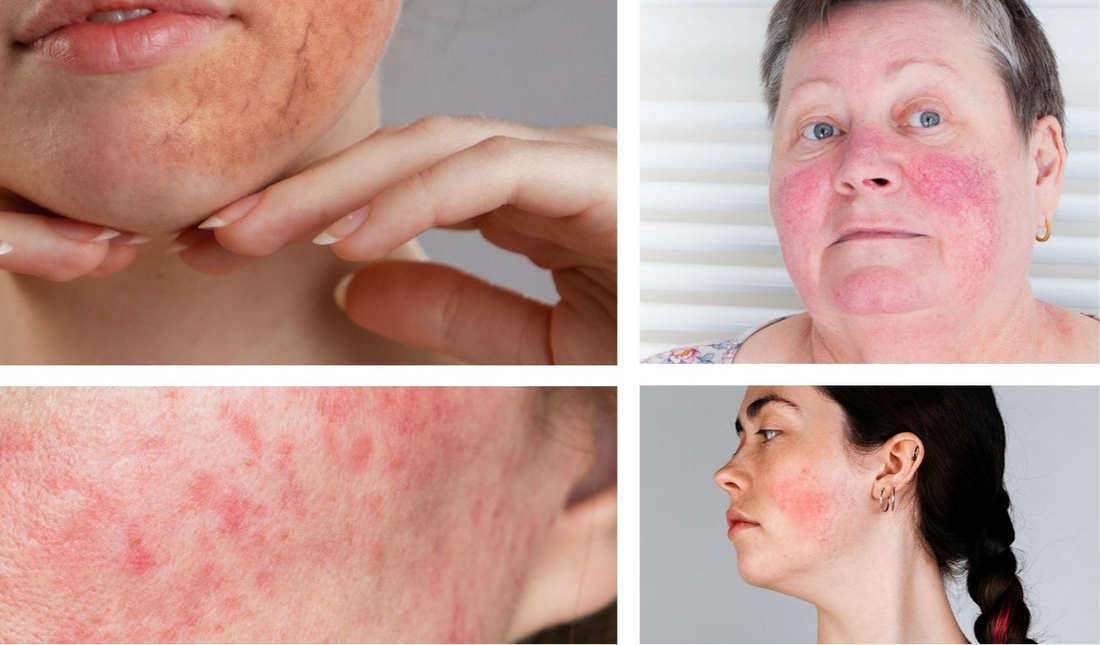 slider image slider_item_Cdayf6