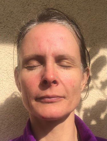 image comparison after