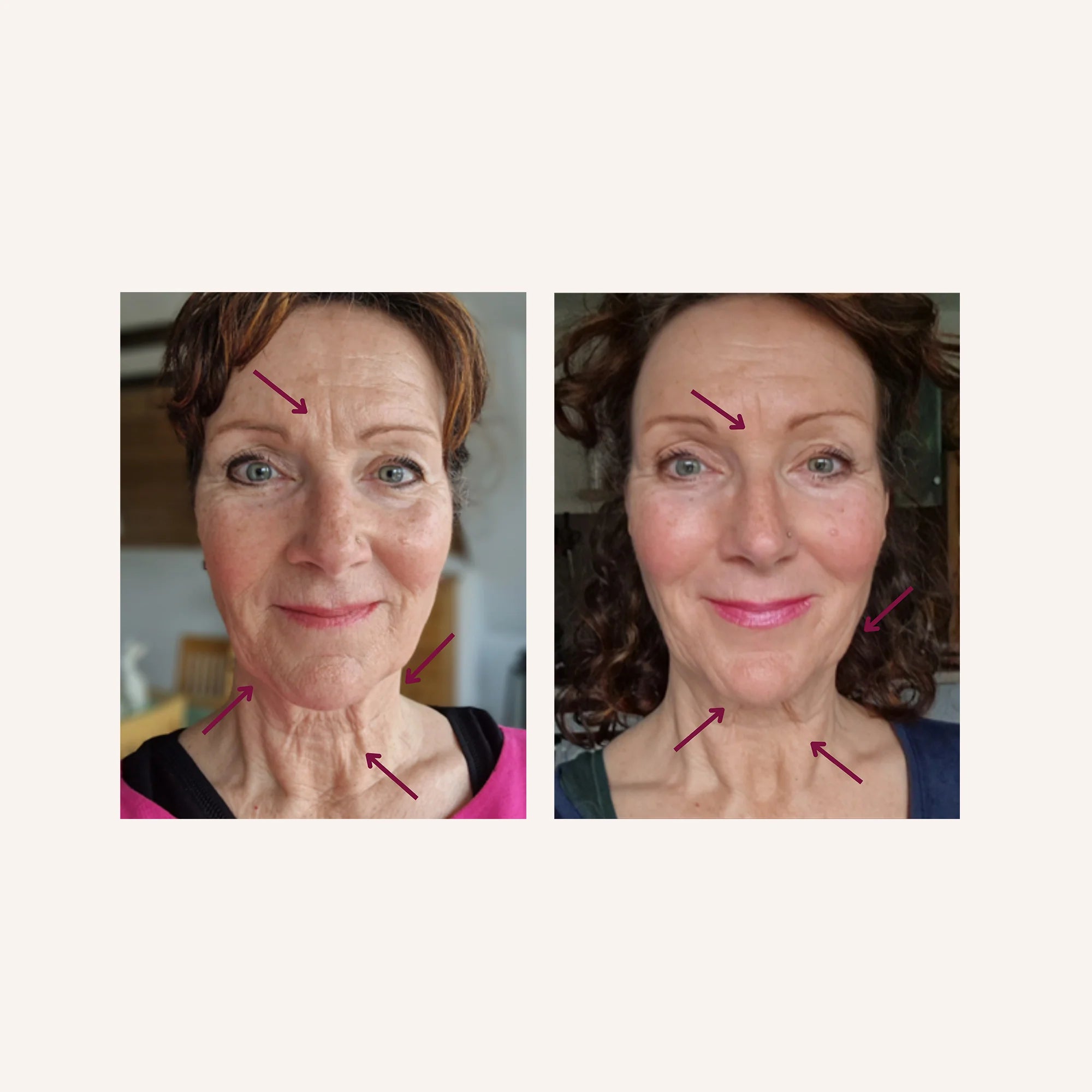 slider image slider_item_RQK3qg